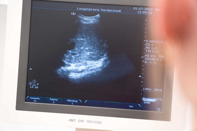 Lungenpraxis Norderstedt Sonographie